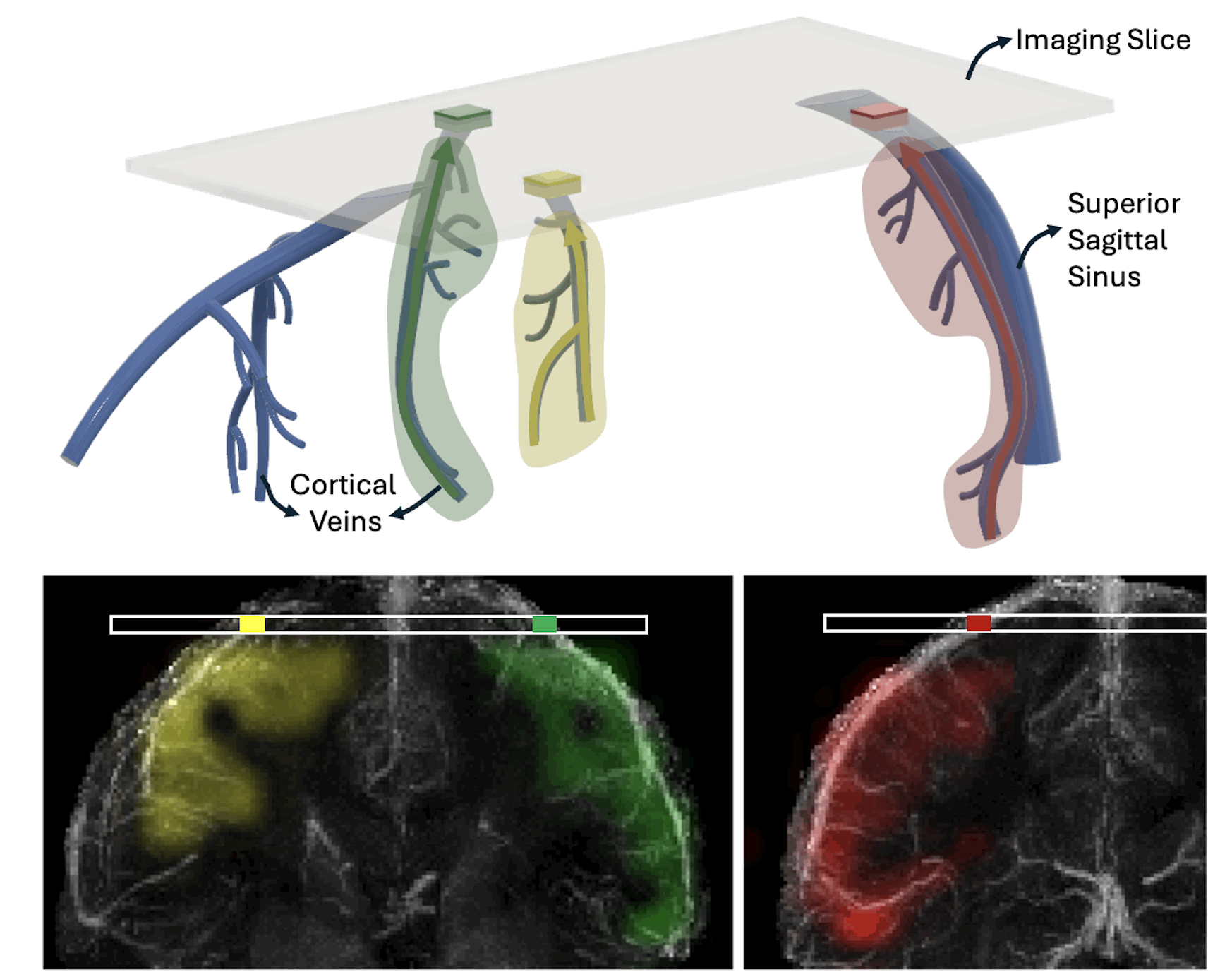 PerfusionSourceMapping_img.png