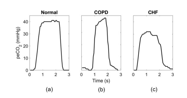 capnography.png